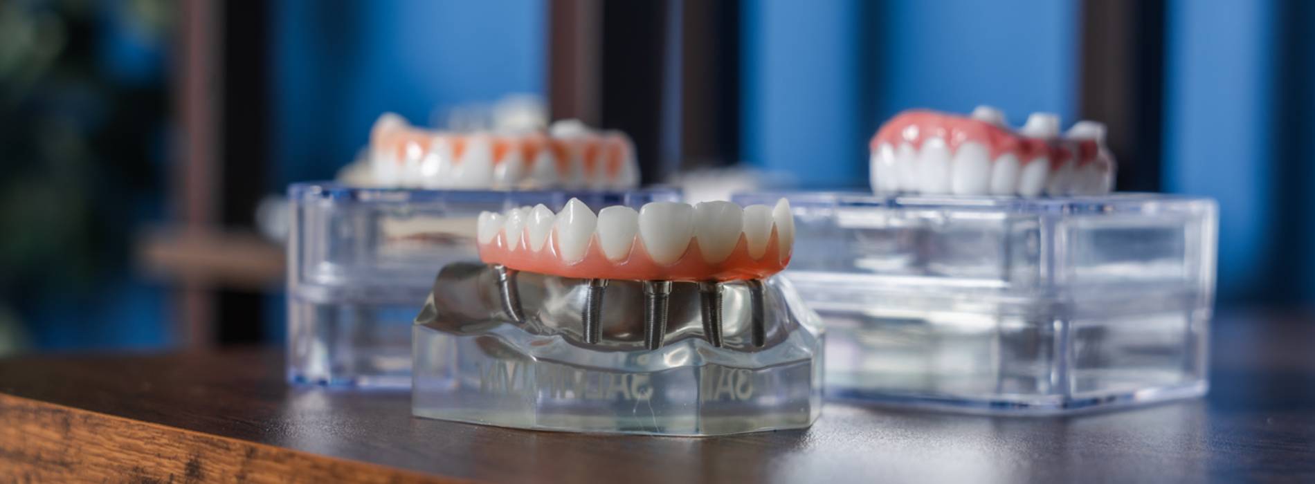 The Wobbly Tooth Dental Practice | Implant Restorations, Crowns and Root Canals