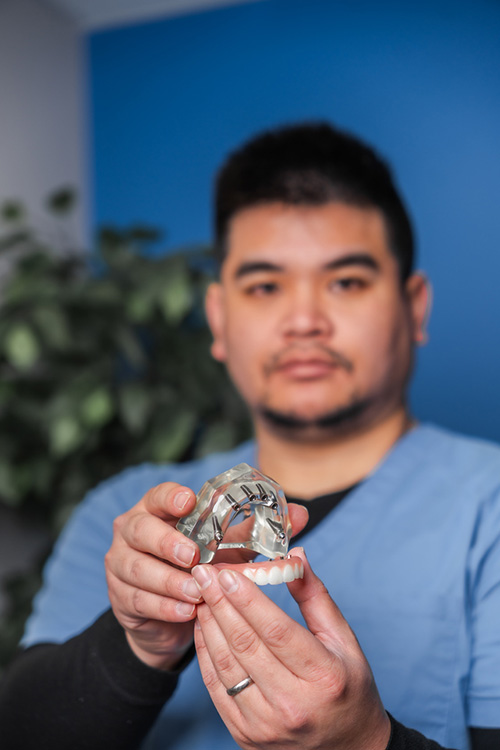 Man holding a dental implant model with his left hand.