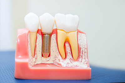 The image shows a close-up view of a dental model with artificial teeth and gums on display, featuring toothbrushes and dental floss inserted into the model s mouth area.
