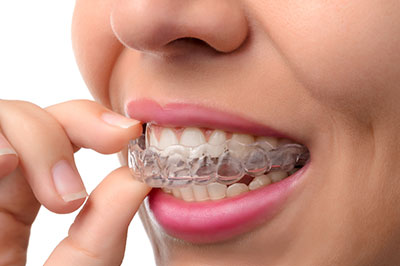 The image features a person with a smile showing multiple teeth alignments, likely from an orthodontic treatment, holding a finger near their mouth.