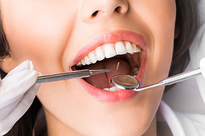 A woman with her mouth open, receiving dental care from a professional, with dental tools visible.